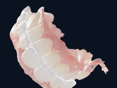 مسح ثلاثي الأبعاد لأسنان المريض